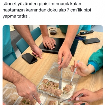 Sünnet riskli bir operasyon değildir.